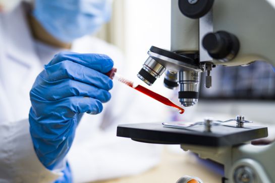 Bloquear la transmisión comunitaria generalizada del virus es importante para controlar el coronavirus Bloquear la transmisión comunitaria generalizada del virus es importante para controlar el coronavirus