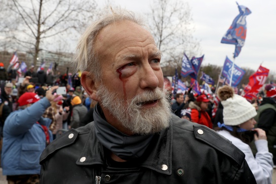 Las imágenes del asalto al Capitolio por manifestantes partidarios de Trump Las imágenes del asalto al Capitolio por manifestantes partidarios de Trump