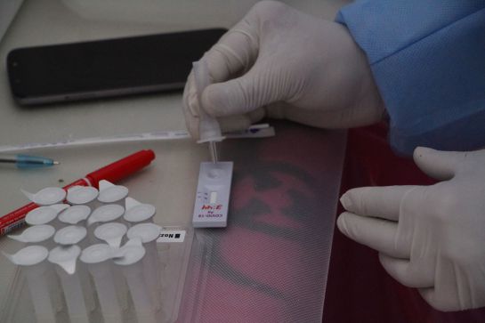 El objetivo es aumentar a 2 mil test COVID diarios El objetivo es aumentar a 2 mil test COVID diarios