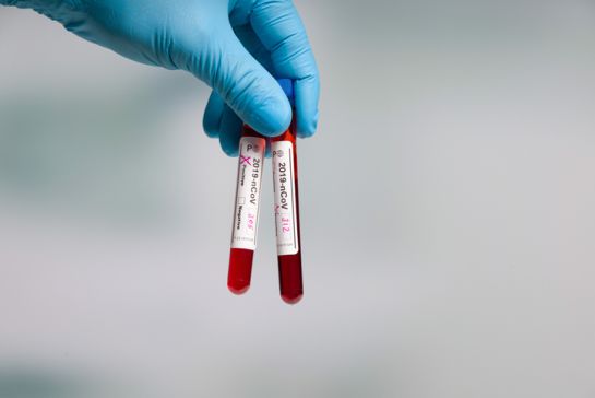 Una prueba de anticuerpos totales COVID-19 permitirá saber si ya tienes anticuerpos Una prueba de anticuerpos totales COVID-19 permitirá saber si ya tienes anticuerpos