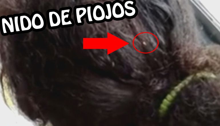 videos de chicas con piojos