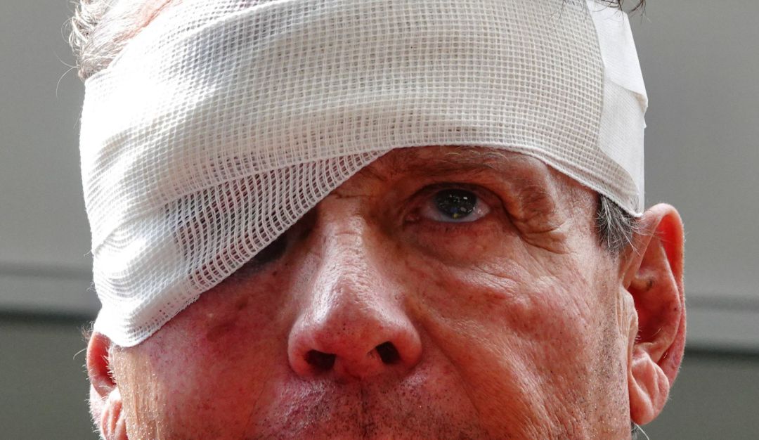 Alfredo adame golpiza Así quedó Alfredo Adame tras ser golpeado afuera